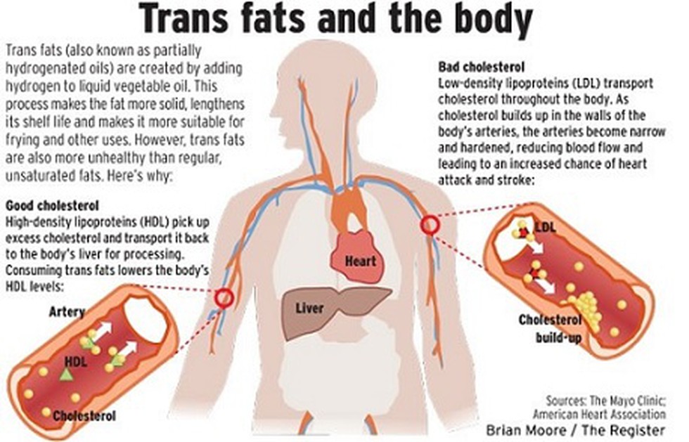 The Fda Just Ordered Food Companies To Stop Using Trans Fat Here S What It Means For You Vox