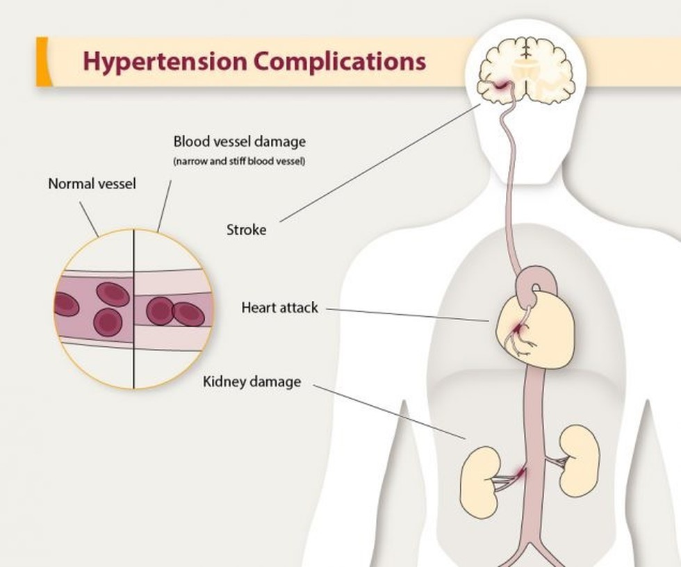 The World Health Organization Recently Released Guidelines For 